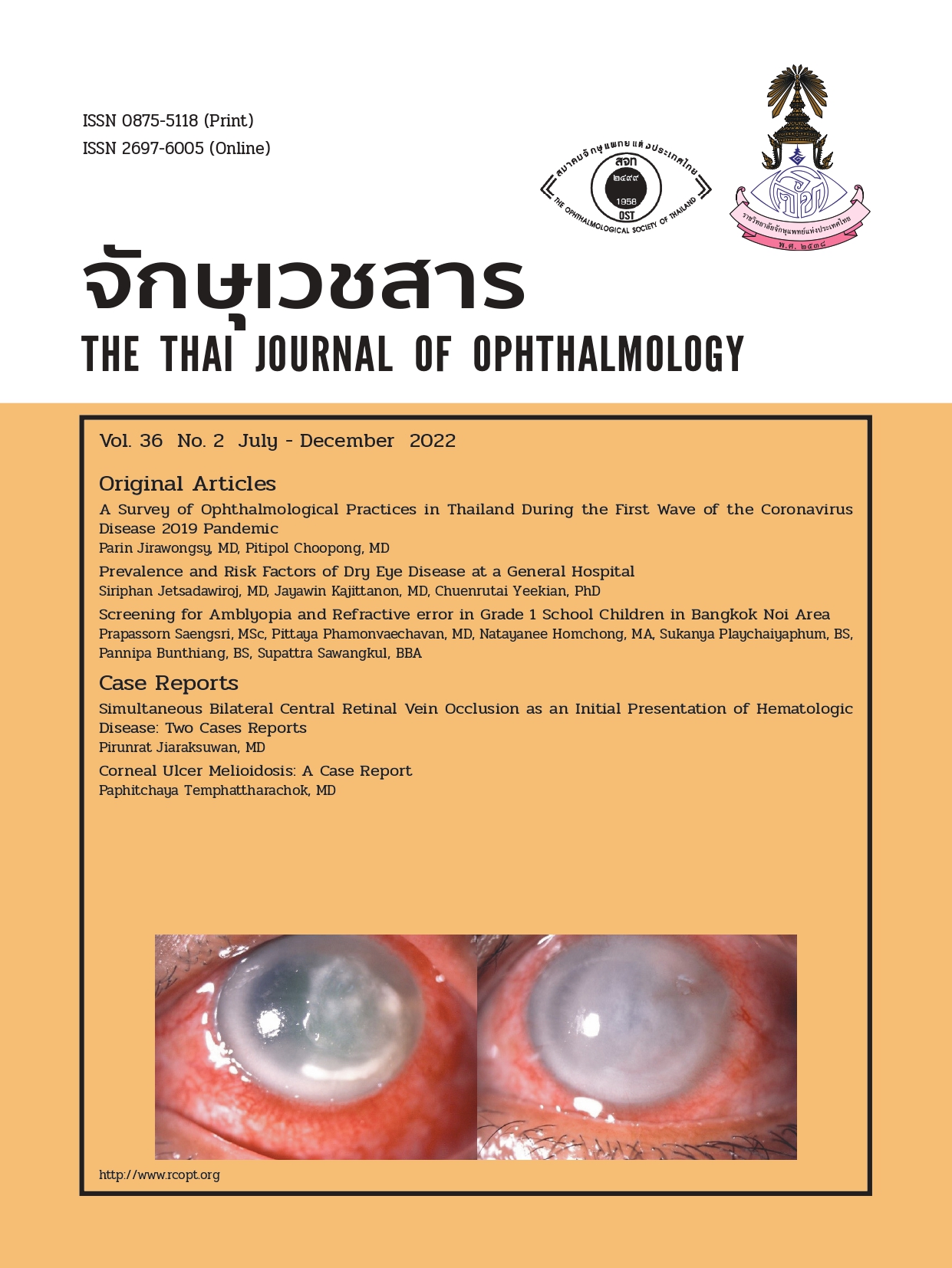2016Cover J Ophthalmol-36-2-65-E2new_pages-to-jpg-0001.jpg